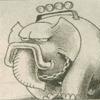 orks